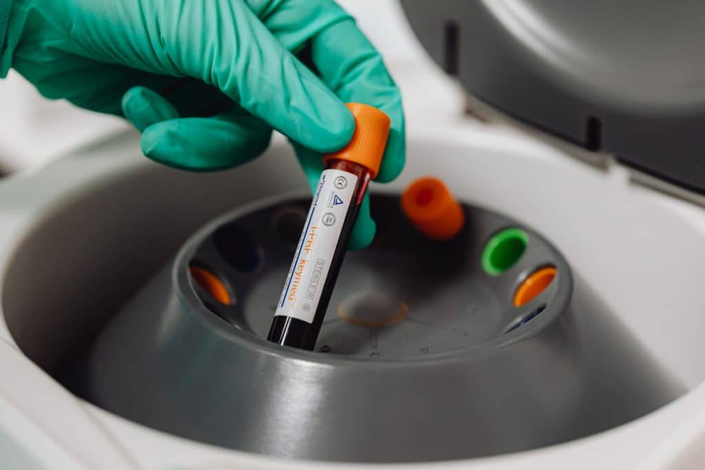 Tubo de sangue sendo colocado em centrífuga para preparo de PRP